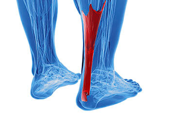 achilles tendon treatment in the Orange County, CA: Huntington Beach (Anaheim, Santa Ana, Irvine, Garden Grove, Orange, Costa Mesa, Westminster, Newport Beach, Tustin, Fountain Valley, Stanton, Seal Beach, Corona Del Mar, Los Alamitos, Rossmoor) areas