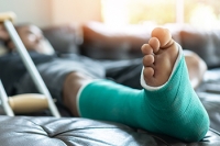 Facts About a Broken Foot